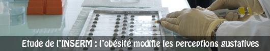 Etude de l’INSERM : l’obésité modifierait les perceptions gustatives