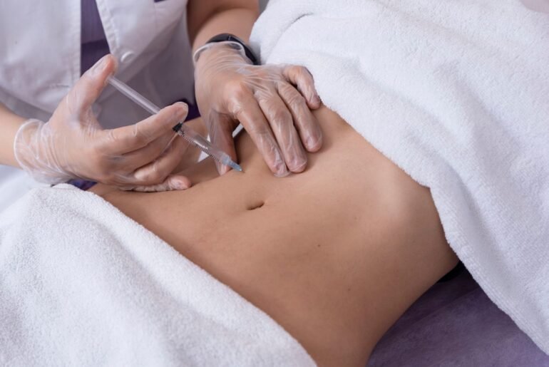 Tout savoir sur la mésothérapie mésothérapie