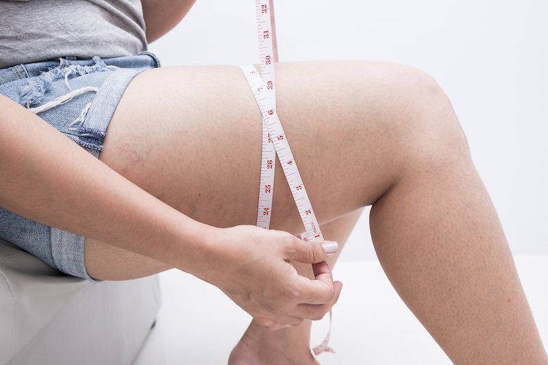 comment maigrir des cuisses