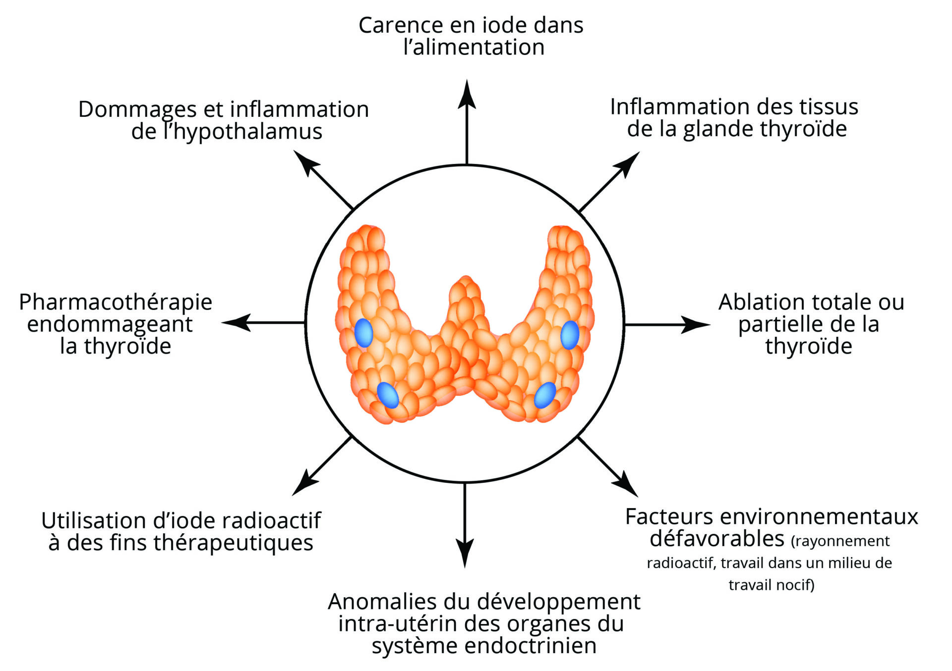 les causes de l'hypothyroïdie