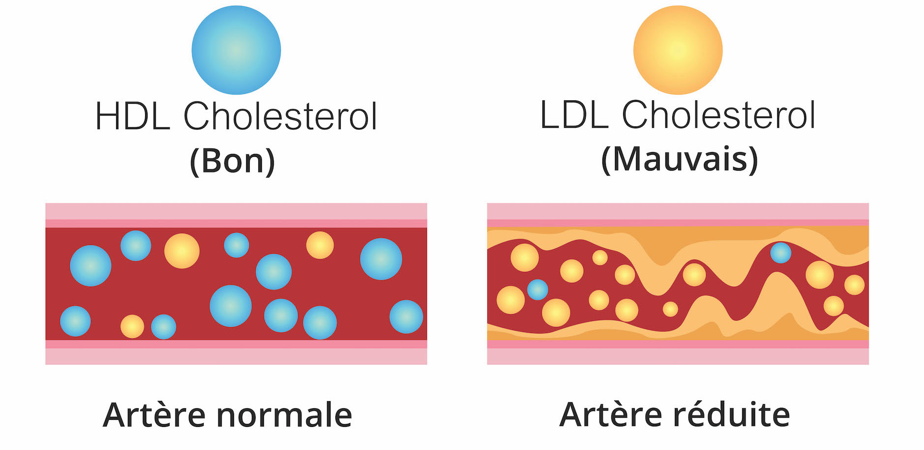 le bon cholestérol et le mauvais cholestérol