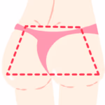 fesses en forme de H