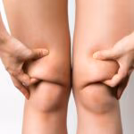 maigrir-des-genoux